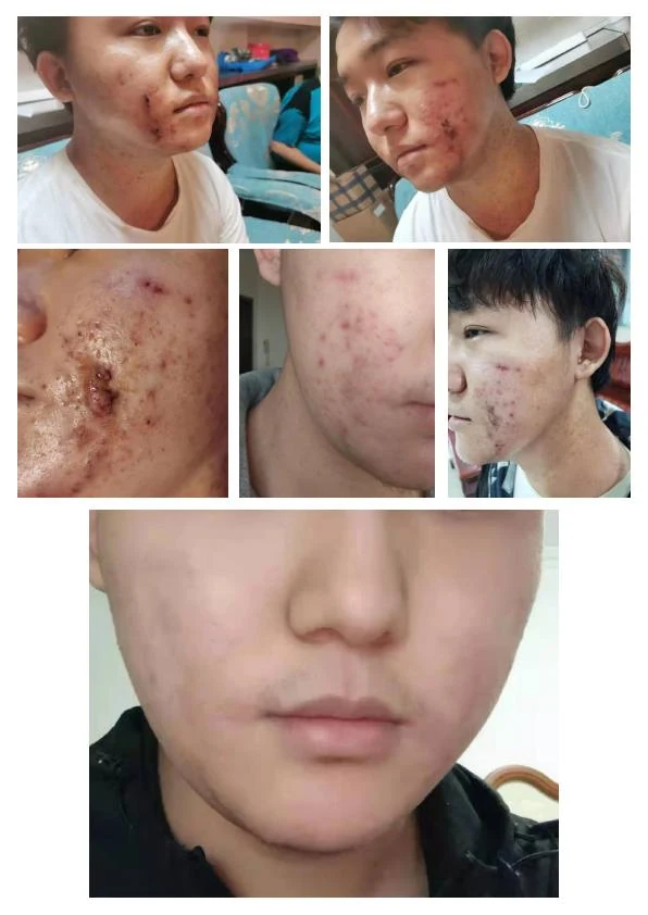 敏感肌肤综合修护记录